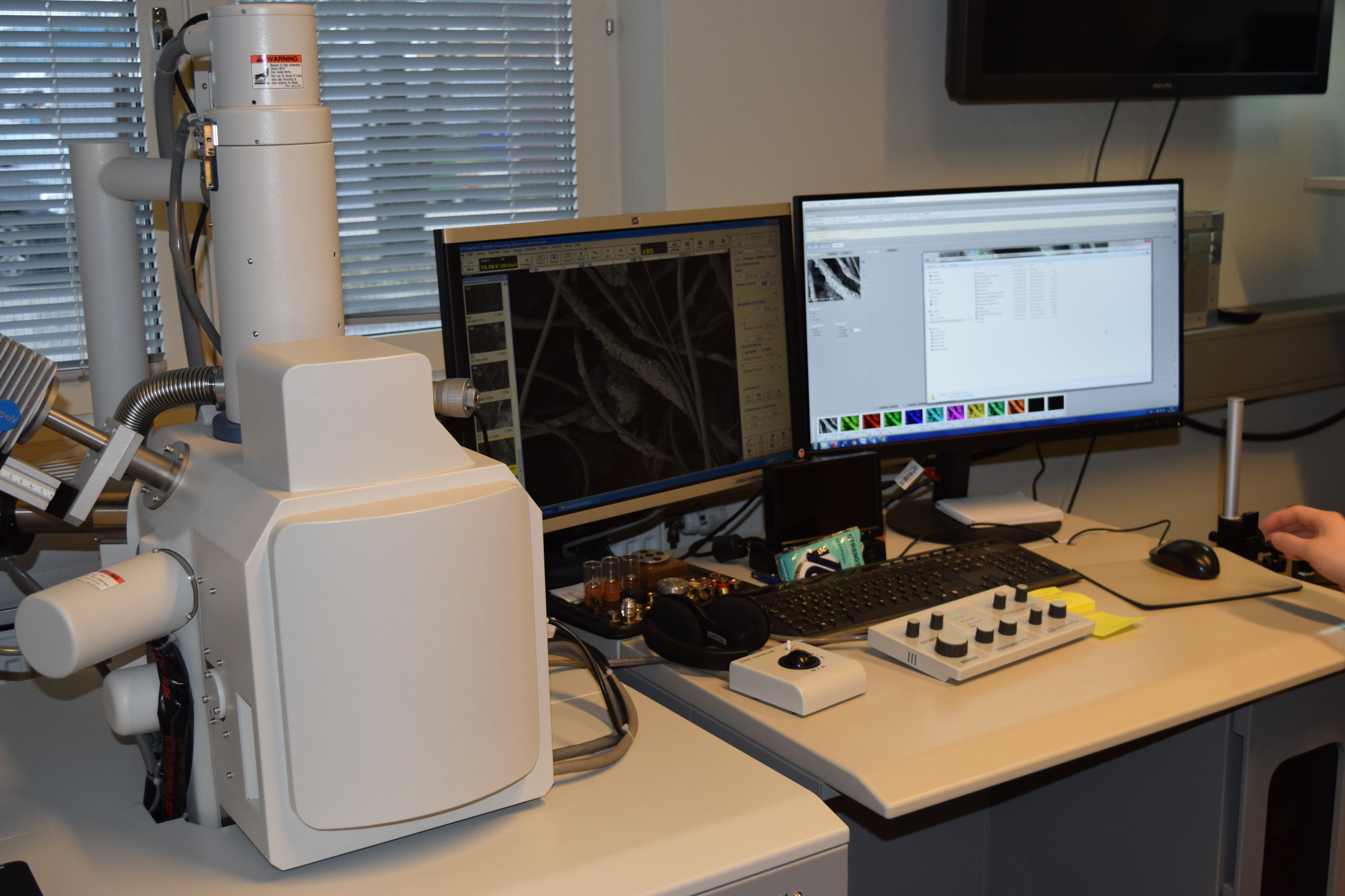Analyse MEB (microscopie à balayage électronique)